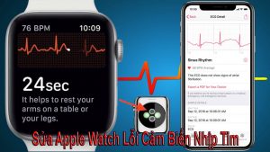 Apple watch lỗi nhịp tim